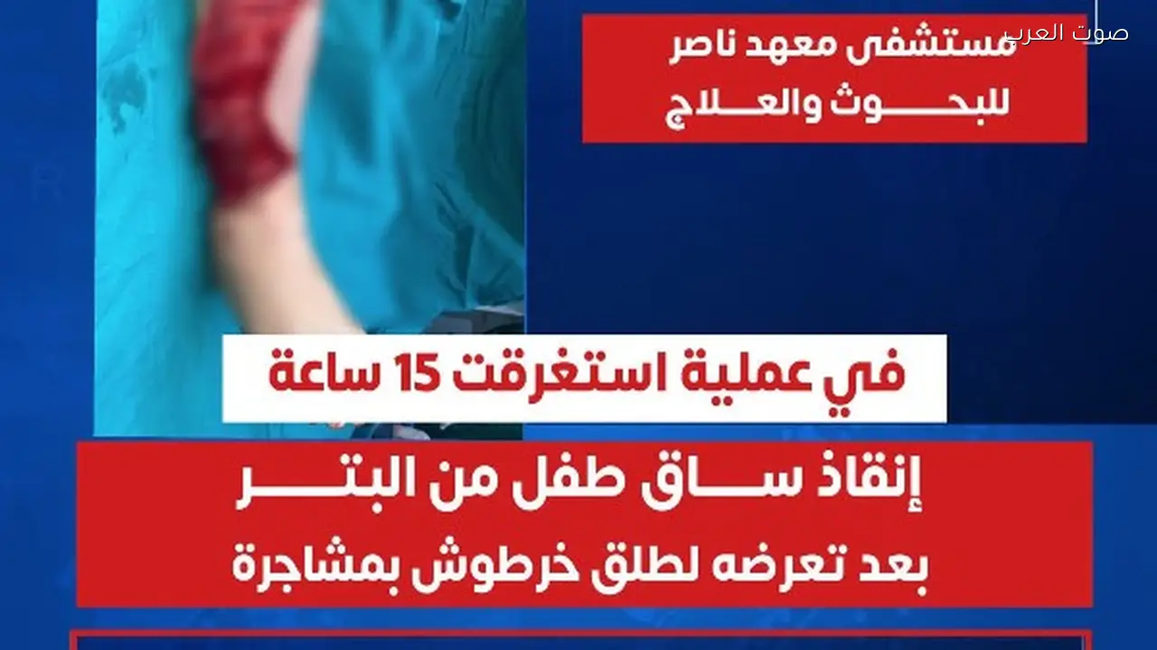 إنقاذ ساق طفل في باسوس بعد عملية استمرت 15 ساعة بمعهد ناصر