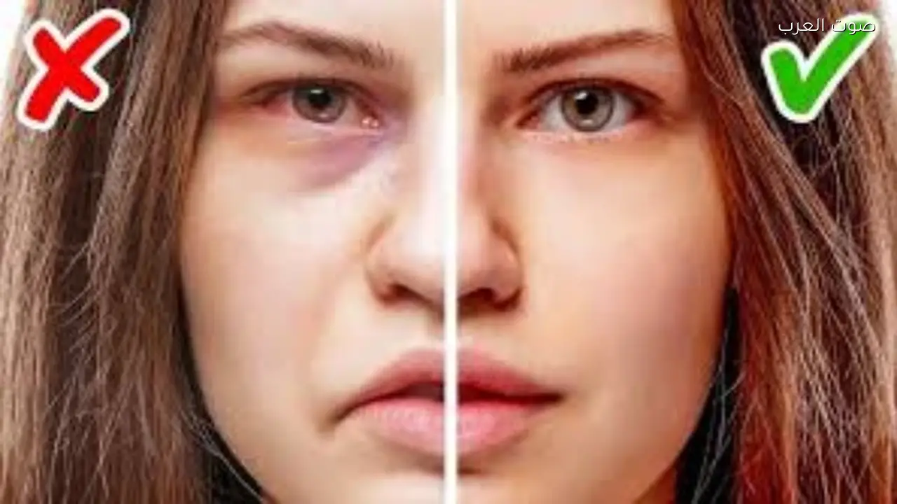 احذر من عرض وجهك فقد يكون علامة على مشكلة صحية