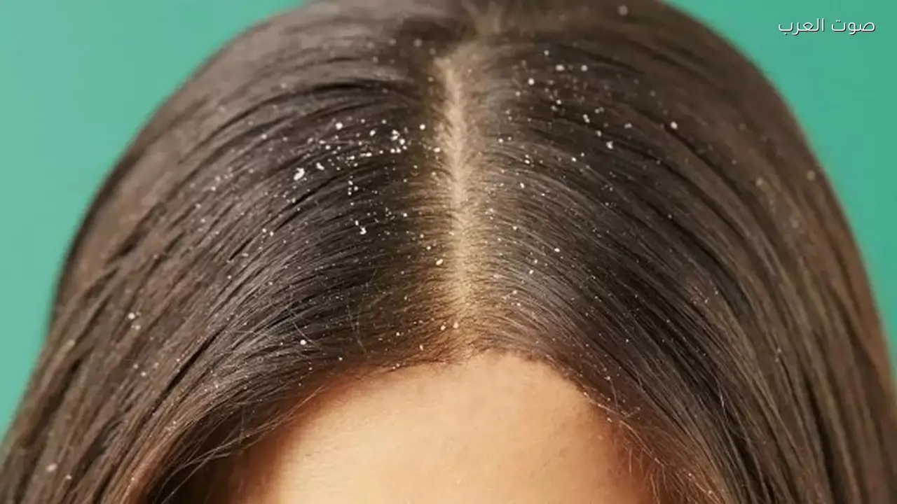 تخلص من قشرة الشعر واعتنِ بصحة فروة الرأس