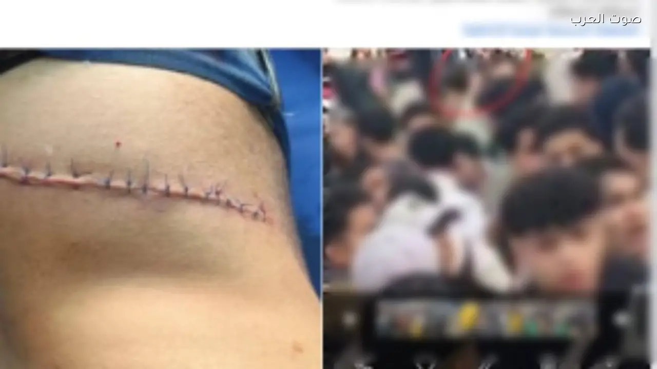 تصالح الطلاب بعد اعتداء بسلاح أبيض في المنوفية