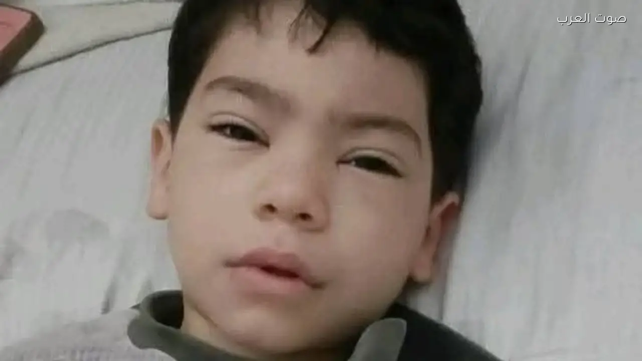 تطورات جديدة في حالة طفل باسوس المصاب بطلق خرطوش بالقليوبية