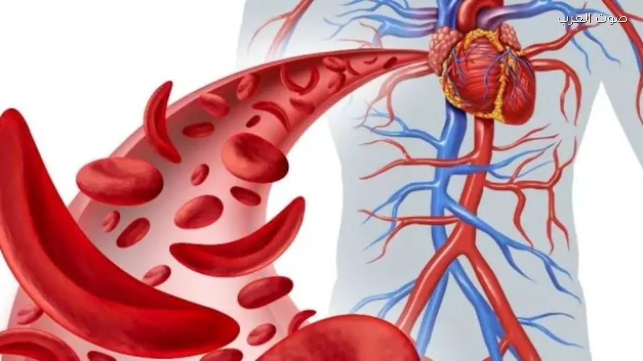 فقر الدم يشكل خطرًا صحيًا على النساء والأطفال