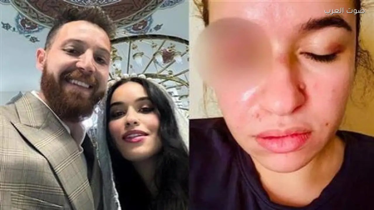 محاكمة محمود حجازي بتهمة الاعتداء على زوجته في 21 فبراير